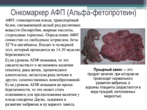 Высокий уровень апф