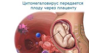 Цитомегаловирус и беременность