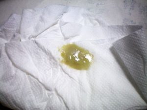 Кашель, слизь с гноем и запахом