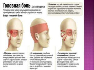 Болит голова когда душно