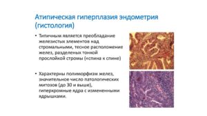 Атипическая гиперплазия эндометрия
