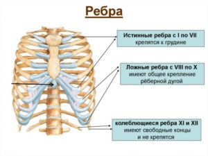 Болит край реберной дуги слева X-XII ребра