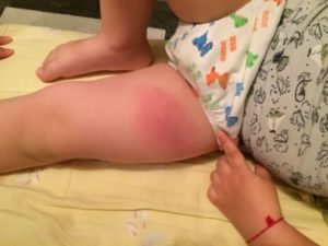 Третья прививка Акдс