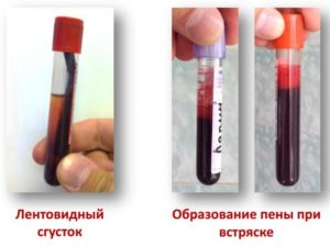 Свернулась кровь при заборе для анализа
