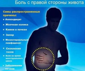 Острая боль внизу живота справа при кашле