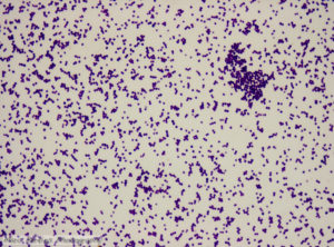 Staphylococcus epidermidis скудный рост (10^2 - 10^3)