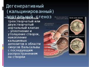 Об уплотнении створок клапанов