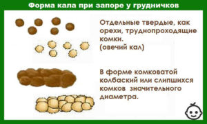 Запор у грудничка ферталь