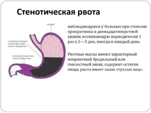 Рвота с запахом тухлых яиц