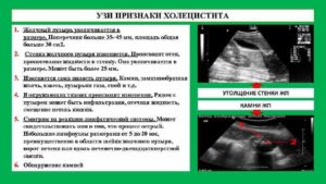 Узи желчного пузыря, признаки хронического холецистита