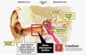 Из уха идет воздух