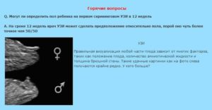 На каких сроках определяют беременность?