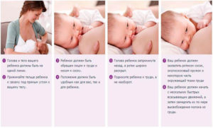 Чем можно заменить полижинакс во время кормления грудью