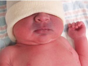 Синеет носогубный треугольник у ребенка 5 лет
