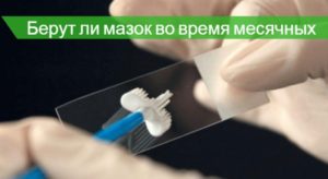 Можно ли сдавать мазки перед месячными