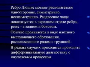 Ребро Люшко
