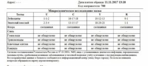 Можно ли сдавать мазки перед месячными
