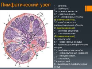 Лимфоузлы увеличены с корковым слоем