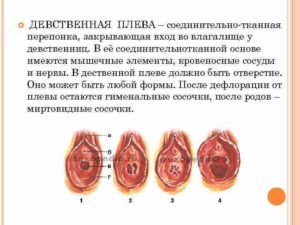 Растянут ли гимен