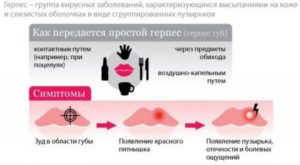 Как жить с герпесом?