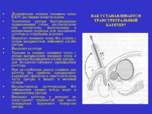 Ожог уретры хлоргексидином