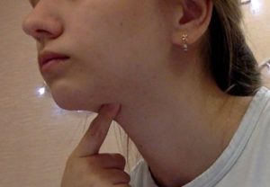 Шарик под челюстью