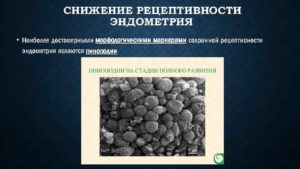 Рецептивность эндометрия