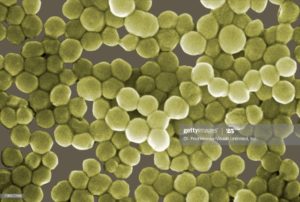 Staphylococcus epidermidis скудный рост (10^2 - 10^3)