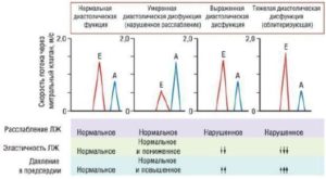 МН 1 степени, ТН 1 степени. Диастолическая дисфункция ЛЖ - 1 тип