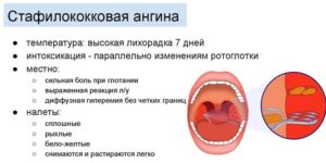 Золотистый стафилококк и хронический тонзиллит