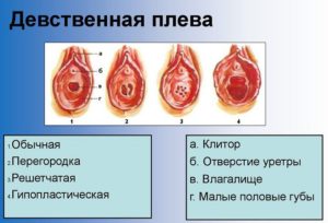 Может ли у 3 месячной девочки быть отсутствие девственной плевы?