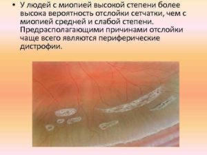 Миопия высокой степени и роды