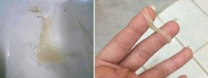 Странные месячные с прозрачной слизью