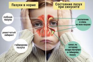 От насмотрка появилась боль в лице