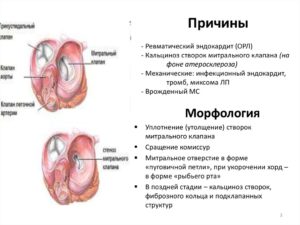 Об уплотнении створок клапанов