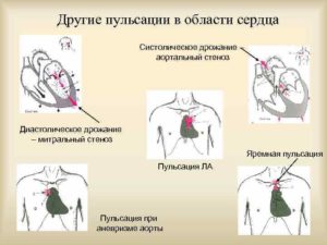 Дрожание в области сердца