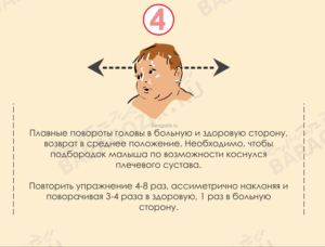 Наклон головы в 3 года