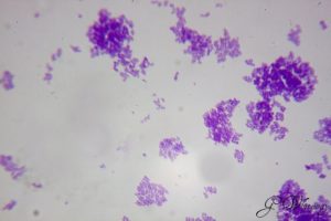 Staphylococcus epidermidis скудный рост (10^2 - 10^3)